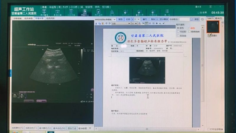 婚前体检不合格的原因有很多，常见的包括：